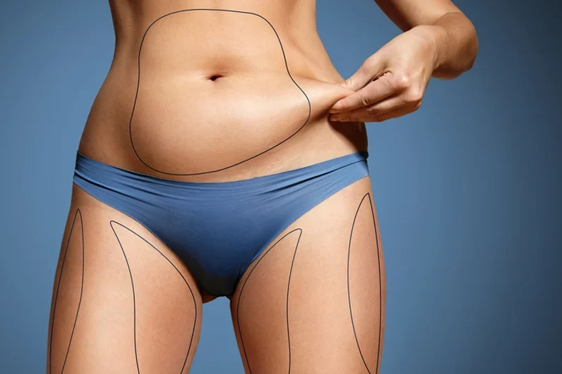 izmir liposuction doktorları
