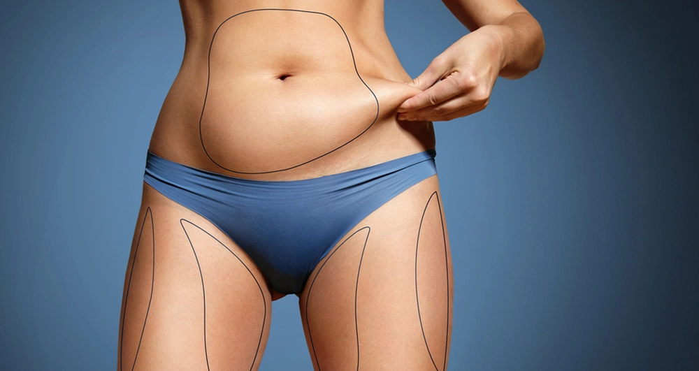 izmir liposuction doktorları izmir liposuction doktorları