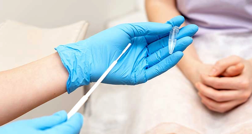 smear testi nedir? smear testi nedir?