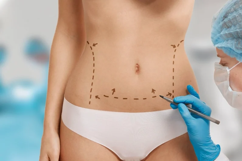 liposuction sonrası iyileşme süreci nasıl hızlanır