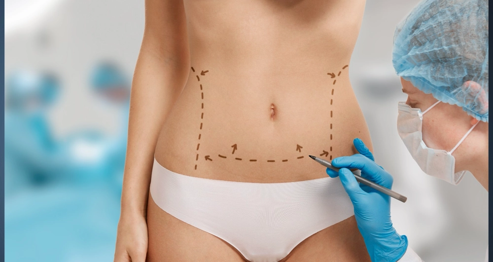 liposuction sonrası iyileşme süreci nasıl hızlanır
