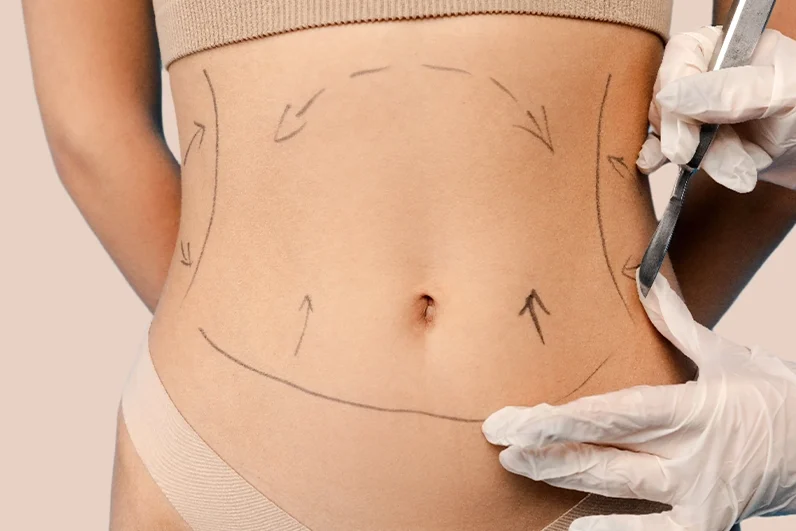 ankara liposuction