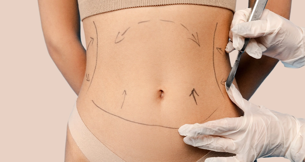 ankara liposuction