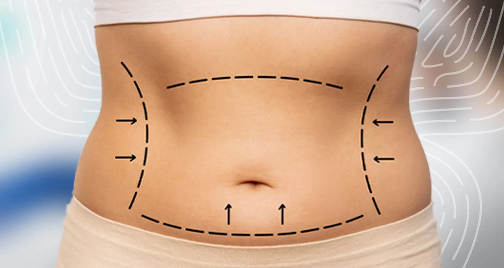 ankara'da en iyi liposuction doktorları